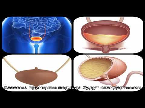 Цистит после интимной