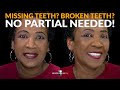 Dental Partial, Flippers Cost Too Much! See This Total Smile Transformation - NODentistVeneer.com