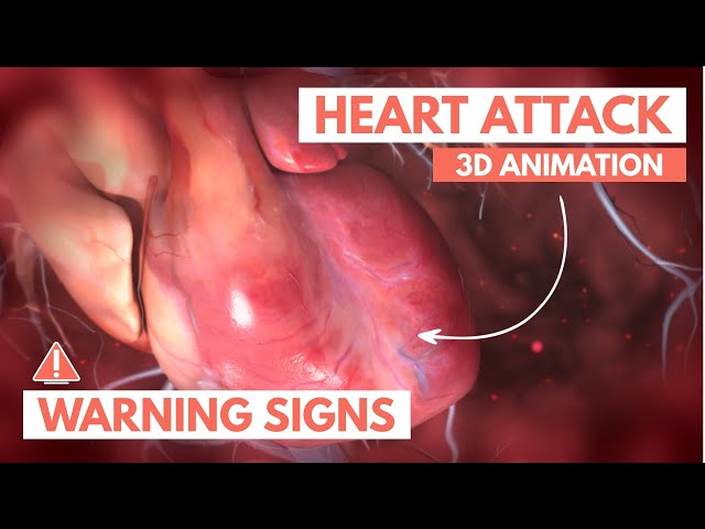 Recognizing a heart attack | 3D Animation class=