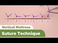 Suture techniques and training series interrupted vertical mattress suture technique
