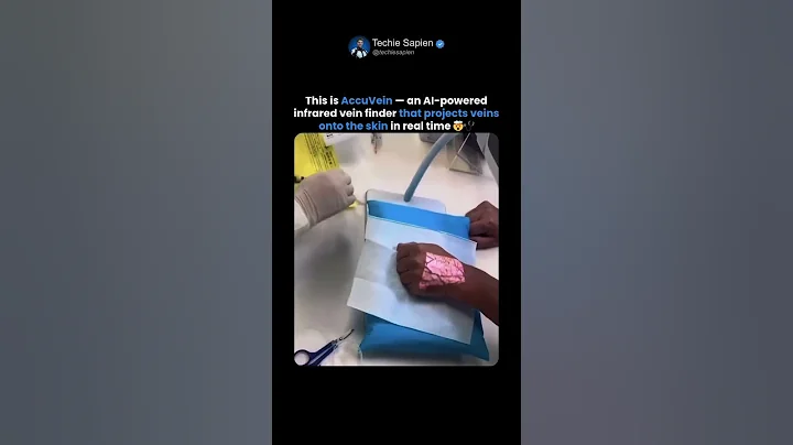 AI Vein Finder Projects Veins on Skin in Real Time 🤯🩺