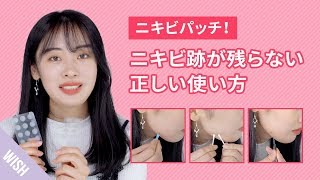 【ニキビケア】 ニキビパッチの正しい使い方！種類ごとに使い方があるって知ってた？