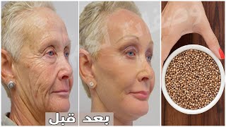 A component,🌱stronger than Botox, 👌 apply it to wrinkles & they will disappear permanently & forever screenshot 5