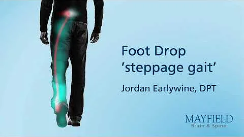 Foot Drop "steppage gait"