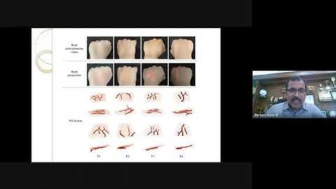 ICE - SKCT - ATAL - FDP on Biomedical Instrumentation and IoT - Day 1 Session 1