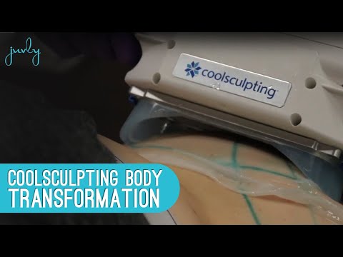 Video: CoolSculpting Vs. Fettsugning: Kostnad, Biverkningar, Resultat, Bilder