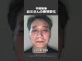 切開リフトで180度変わったお父さんの表情変化!#切開リフト #フェイスリフト #韓国美容 #リフトアップ #症例写真