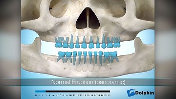 Dolphin Imaging & Management Solutions: Aquarium© software video montage