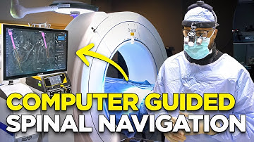 Computer Guided Spinal Navigation (FULL PROCEDURE)!!