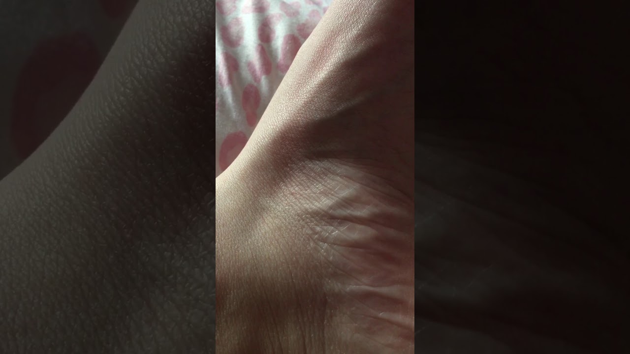 BFS Muscle twitching foot YouTube