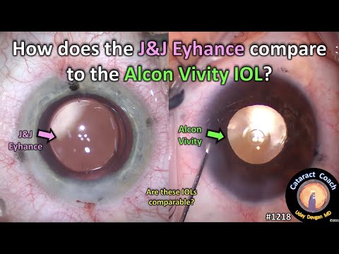 CataractCoach 1218: J&J Eyhance compared to the Alcon Vivity IOL