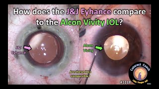 CataractCoach 1218: J&J Eyhance compared to the Alcon Vivity IOL