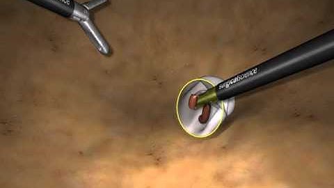 LapSim Basic Skills: Grasping