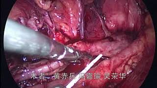 病例十：腹腔镜下输尿管中段狭窄切除再吻合术