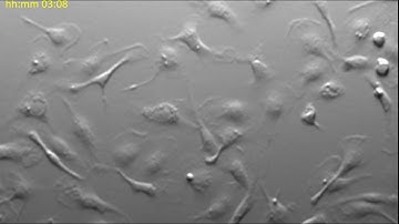 Microglia monoculture pre-LPS (brain immune cells, 2D in vitro culture)