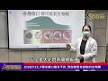 20260723 #慢性傷口癒合不良 別忽略惡名昭彰的生物膜—大北門新聞網