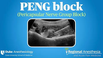 PENG Block (Pericapsular Nerve Group Block)