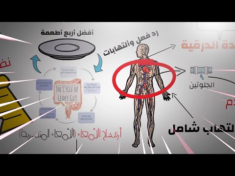 ارتشاح الأمعاء 4 أطعمة لعلاجه بشكل نهائي