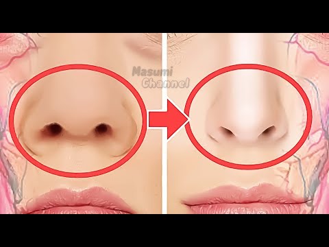 SLIM NOSE EXERCISES! Make Nose Smaller, Sharper | Fix Fat, Round Nose | Slim Down Your Nose Fat