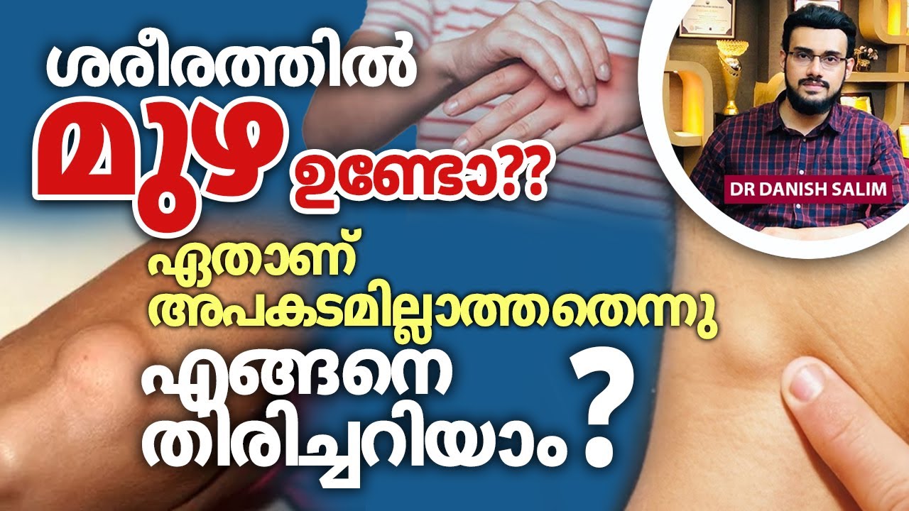 2223: മുഴ ഉണ്ടോ? എങ്ങനെ തിരിച്ചറിയാം?  | Red Flags Explained
