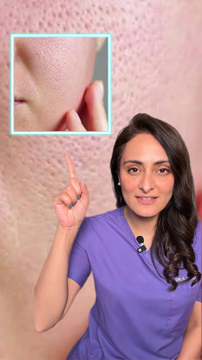 Open pores | how to treat | what to do & what to avoid