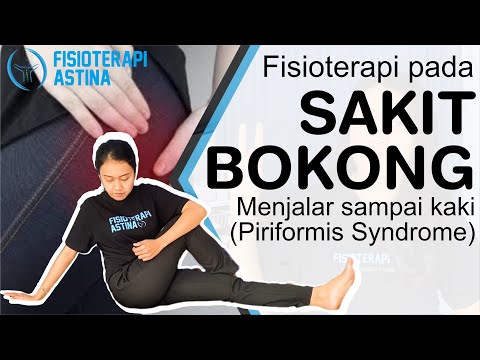 Cara Mengatasi Sakit Bokong | Fisioterapi Nyeri di Bokong Belakang (Piriformis Syndrome)
