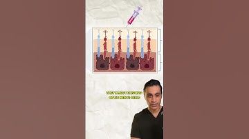 This bionic eye turns camera vision into brain signals!  With gene therapy and a retinal implant, th