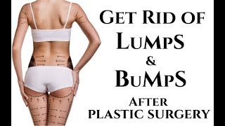 5 Way to Get rid of Lumps After Liposuction - Raadina Health