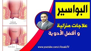 علاج البواسير - افضل طرق علاج البواسير الداخلية والخارجية | الأسباب والحلول.