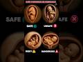 Baby Position in pregnancy #pregnancytips #babyshorts #pregnant