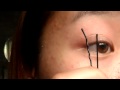 Cheap, Simple, Easy way of getting Double Eyelid