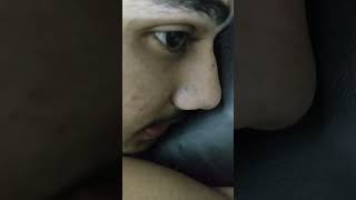 #shorts Hijama experience | Calm & care #youtubeshorts #hijama