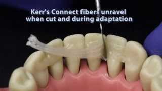 Ribbond compared to other dental fiber reinforcement materials