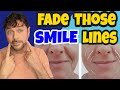 5 Ways To Fade SMILE LINES (Marionette Lines) | Chris Gibson