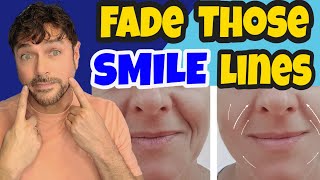 5 Ways To Fade SMILE LINES (Marionette Lines) | Chris Gibson