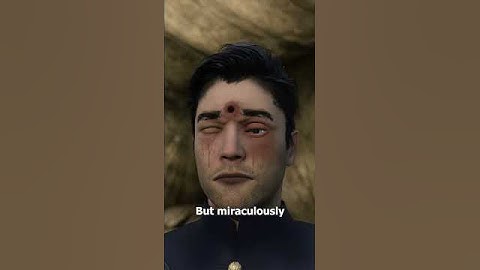Soldier Survives Bullet To The Brain 😮