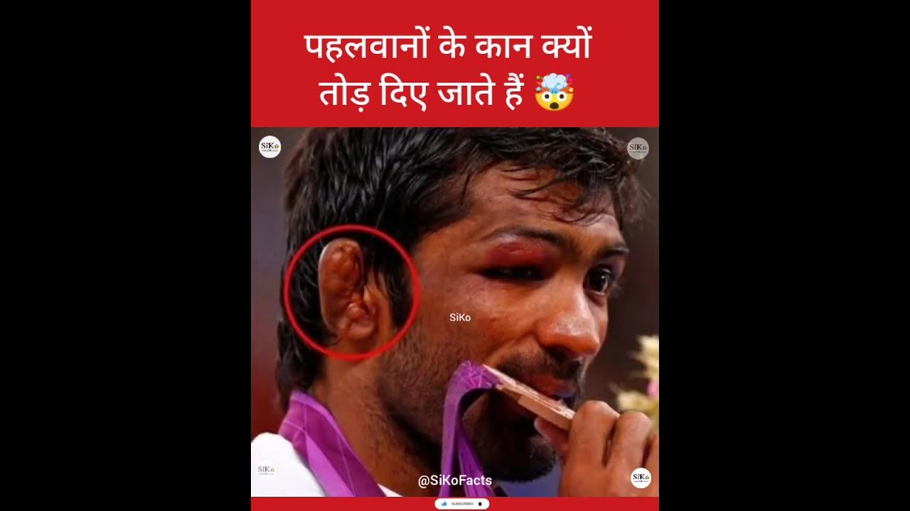 पहलवानों के कान कैसे टूटते हैं 🤯 Why Wrestlers Ears is Different