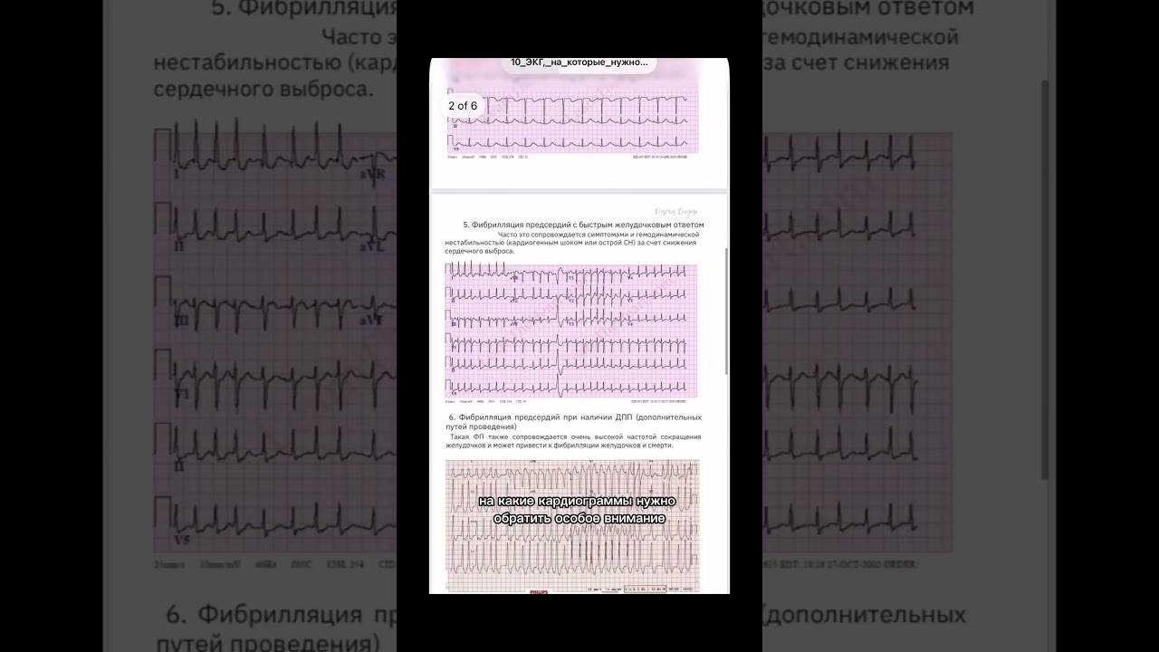 Опасные для жизни состояния