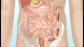 Bowel incontinence and chronic constipation