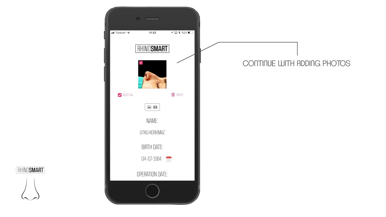 Rhinosmart App (Long Version) by SureyyaSeneldir