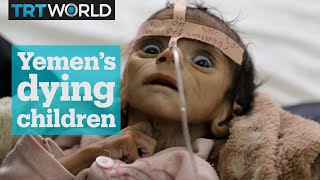 Yemens Dying Children