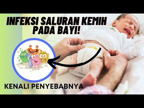 Video: Saluran apa yang pertama kali muncul untuk bayi?