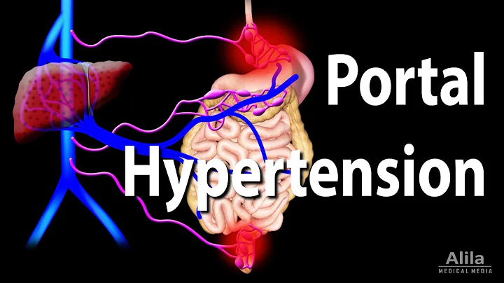 Portal Hypertension, Animation - DayDayNews