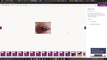 Using PowerApps AI Builder to Diagnose Conjunctivitis(1/3)