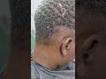 the treatment that regrow your hair instantly in one day
