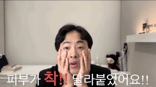 리프테라2 리프팅 레이저 2주 후기!