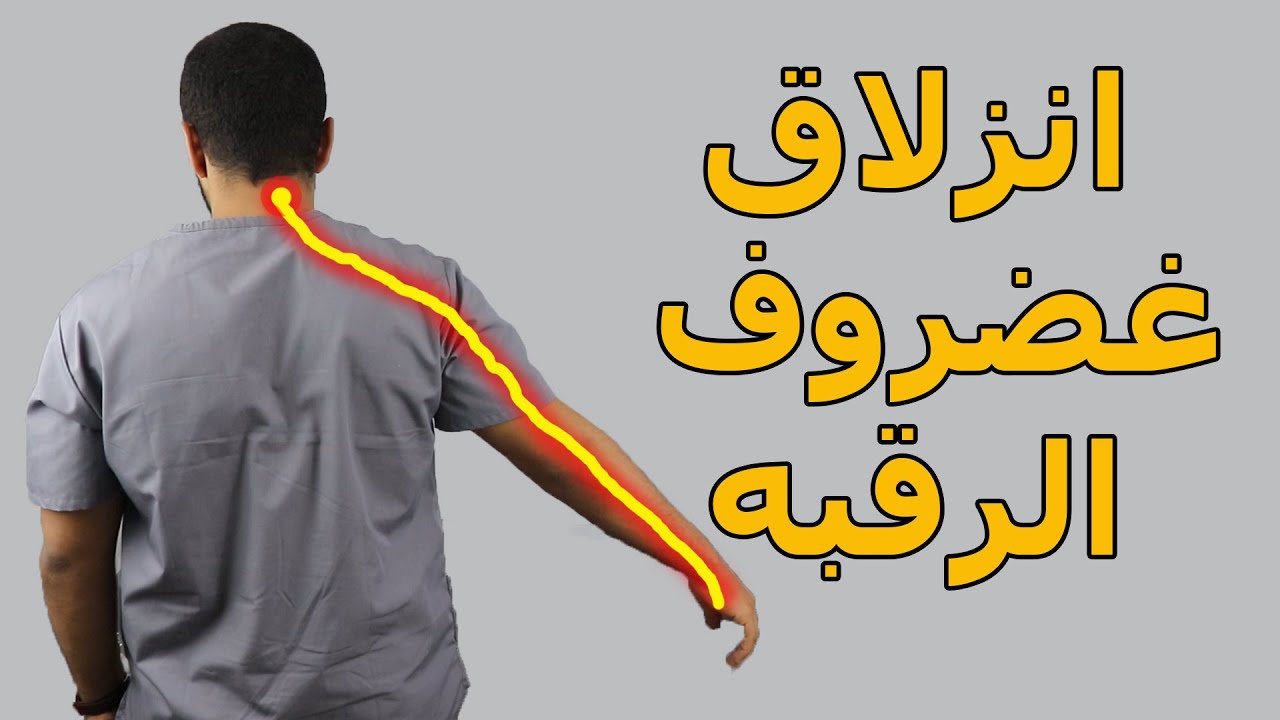 وداعا انزلاق غضروف الرقبة وتنميل وكهربة الايد بدون جراحة/بخطوتين بس تخلص من الانزلاق الغضروفي العنقي