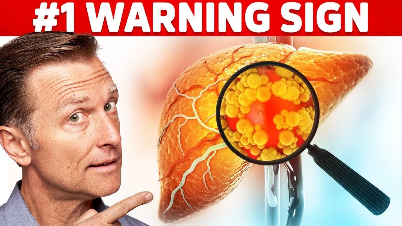 ⁣The #1 Top Warning Sign You Have a Fatty Liver