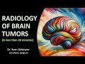 Radiology of brain tumors  the absolute basics