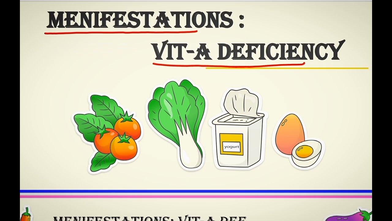 National Vitamin A Prophylaxis Program Part3 ( Manifestations of VitA